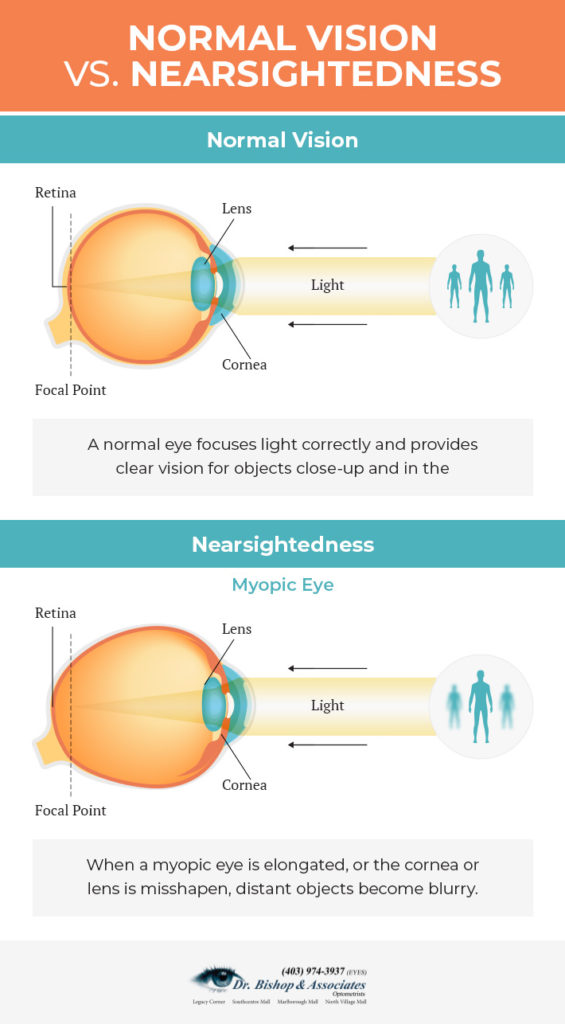 what-does-nearsighted-mean-calgary