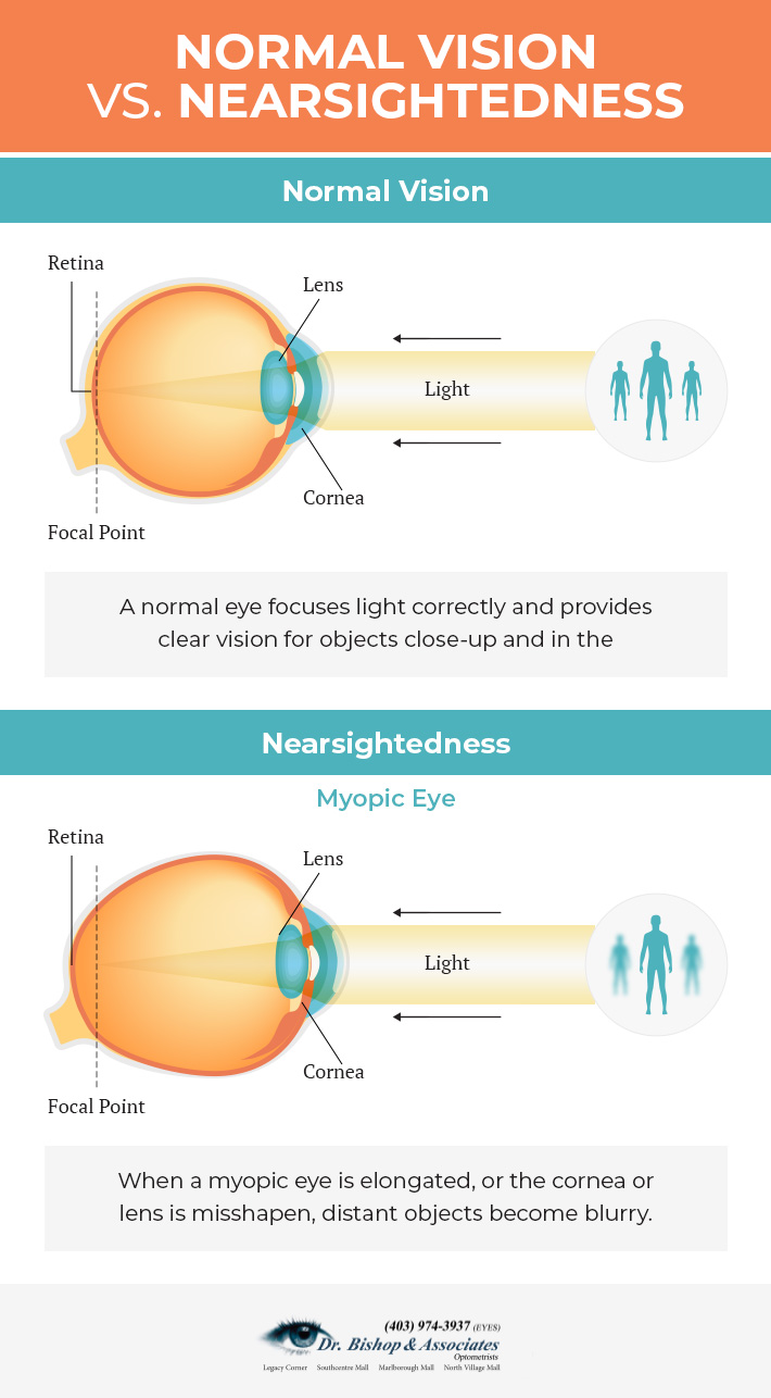 Normal Vision VS Nearsightedness 