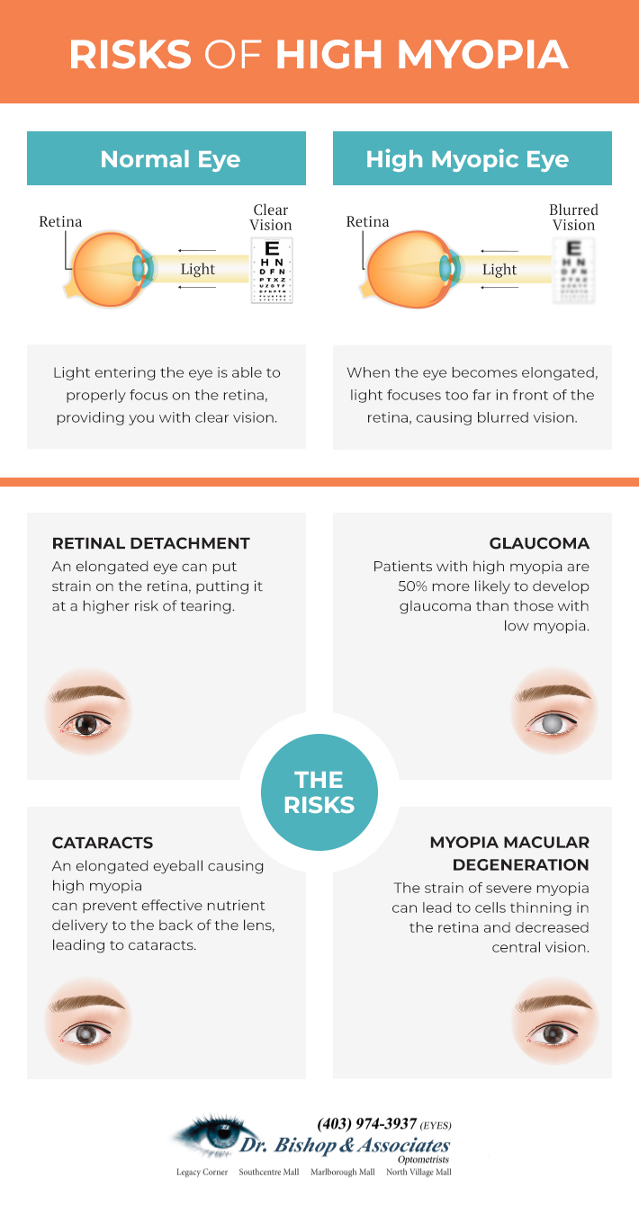 High Degenerative Myopia