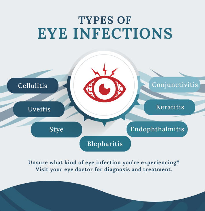 An infographic highlighting all the types of eye infections.