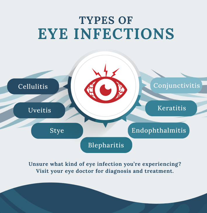 Eye Discharge: Causes, Types and Treatment