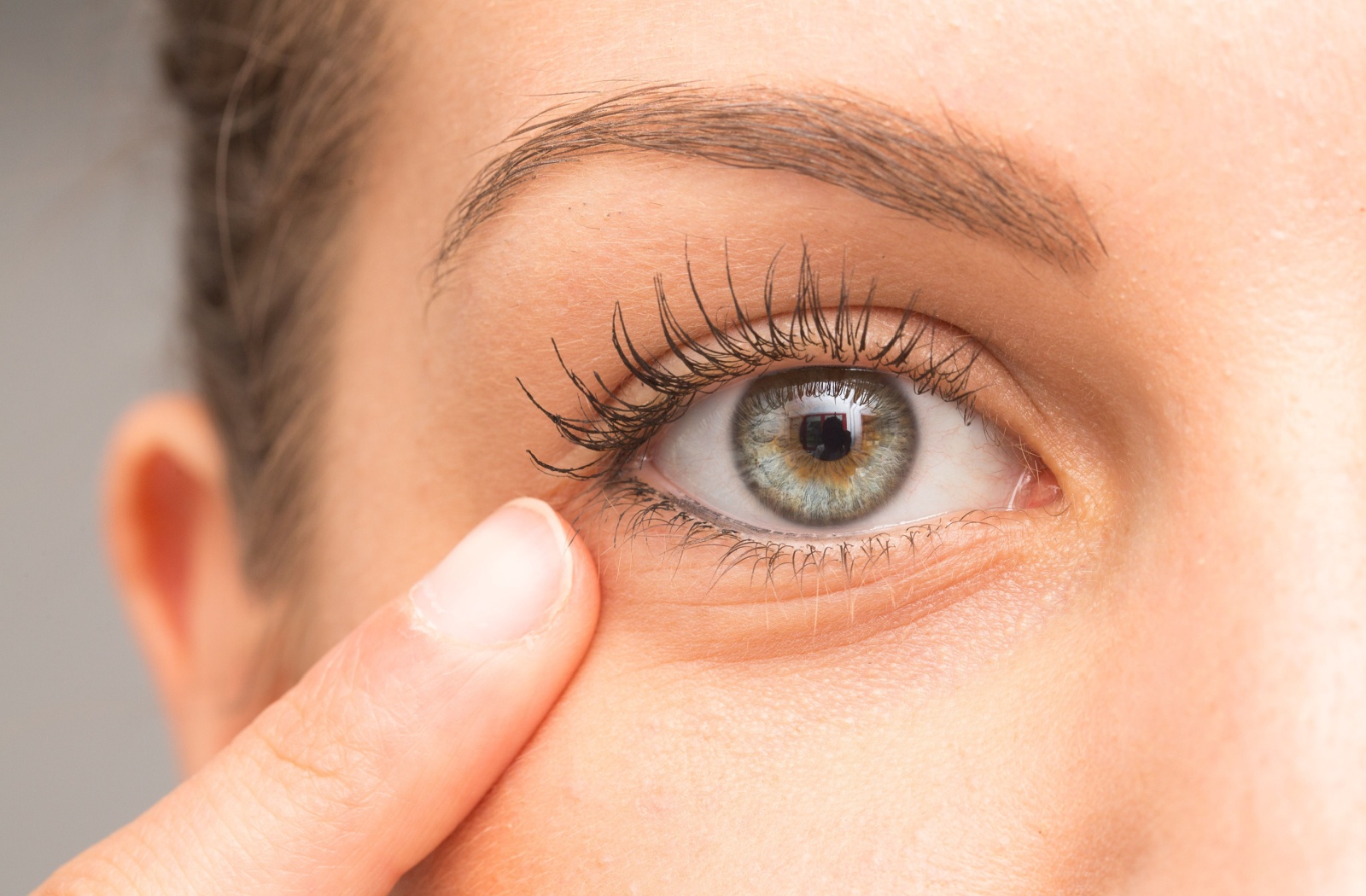 Close-up of a person's right eye. It is greenish hazel with a slight puffiness around the eye.
