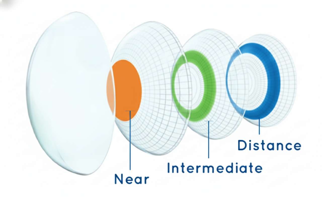 Diagram showing the design of a multifocal contact lens with distance, intermediate, and near vision zones for clear vision at multiple distances.