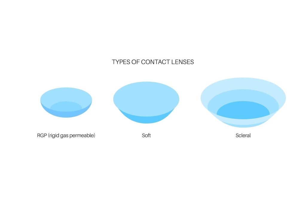 Illustration showing three types of contact lenses—rigid gas permeable (RGP), soft, and scleral lenses—used for different vision correction needs.