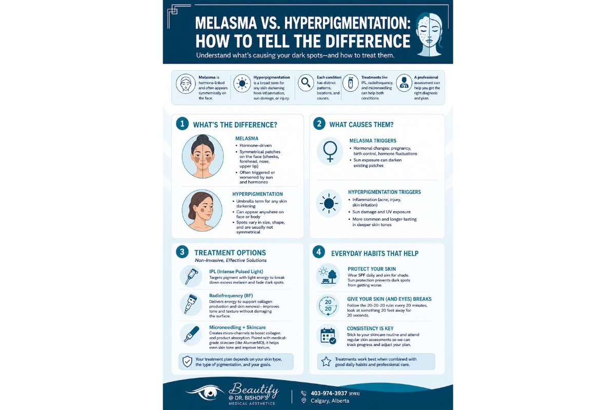 Infographic titled “Melasma vs. Hyperpigmentation: How to Tell the Difference” comparing common causes, patterns, and treatment options. It explains that melasma is hormone-linked and often appears symmetrically on the face, while hyperpigmentation is broader and can result from sun damage, acne, or skin irritation. The infographic highlights IPL, radiofrequency, microneedling, skincare, sun protection, and professional skin assessments as ways to support treatment.